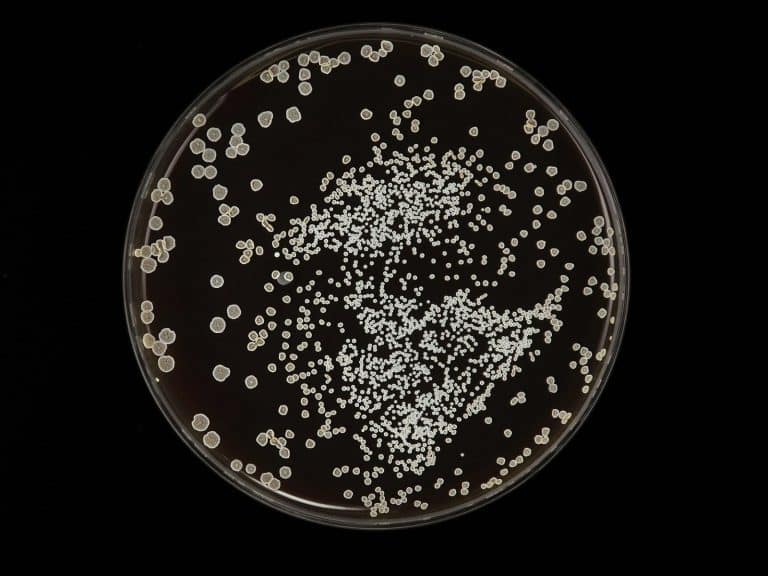 Bacterial colonies growing on an agar plate