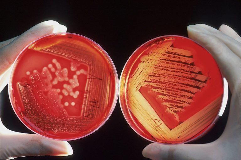 Gloved hands holding two agar plates with microbial colonies.