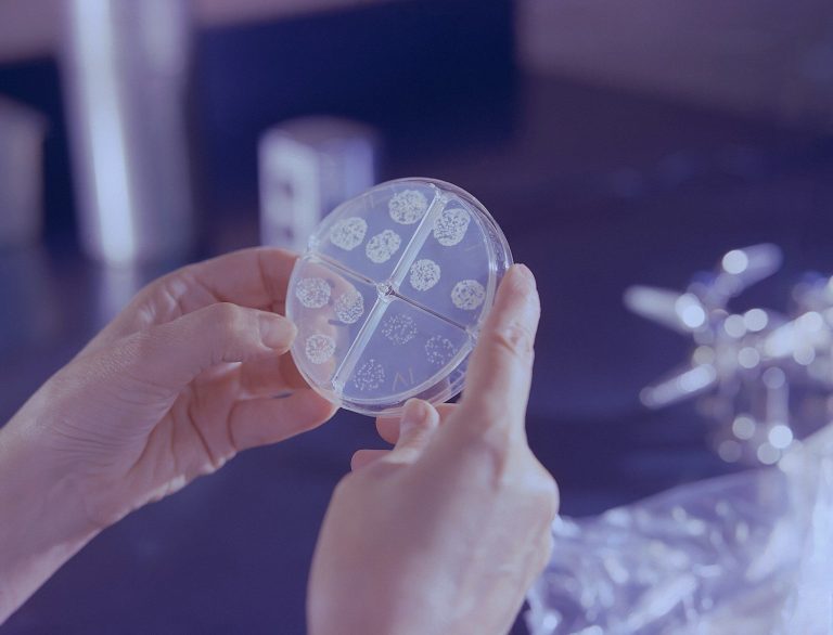 Gloved hands holding a petri dish with microbial colonies growing on the agar.